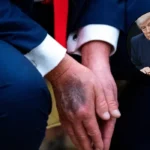 Trump’s 3rd Walter Reed Check‑up in Second Term