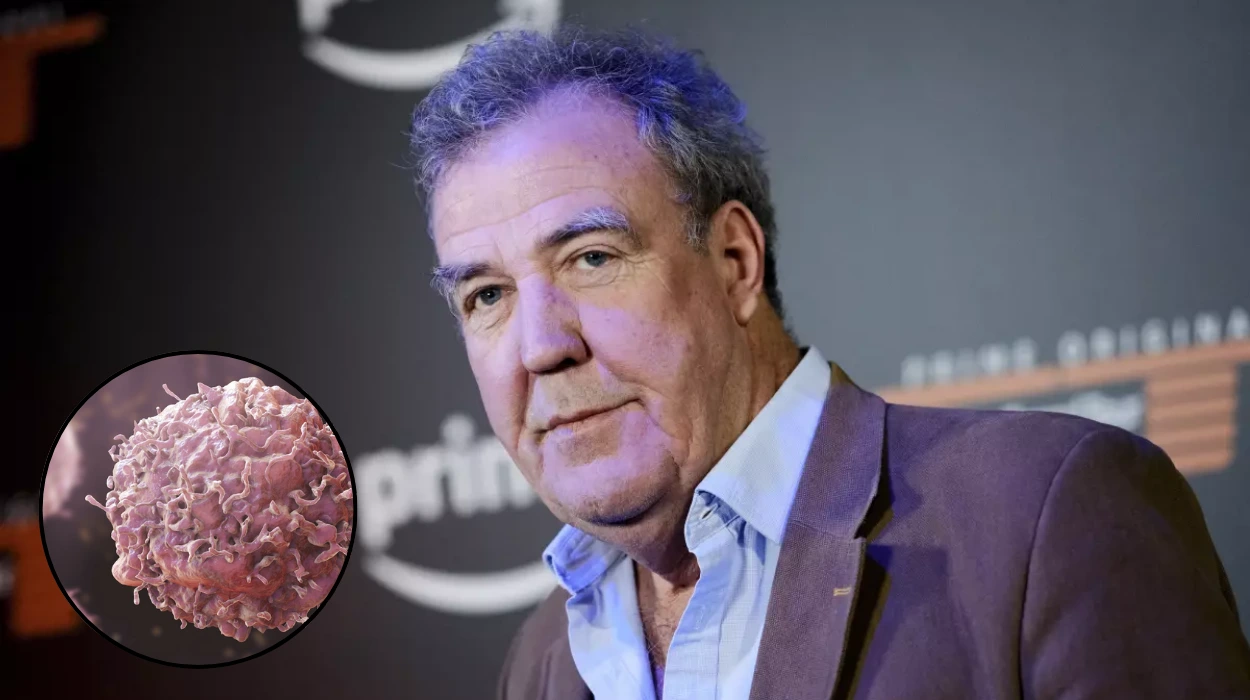 Jeremy Clarkson Diagnosed with Aggressive Prostate Cancer