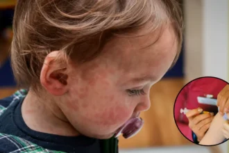 Two children die as measles spreads in London outbreak